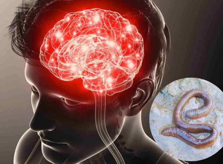 il verme che attacca il cervello